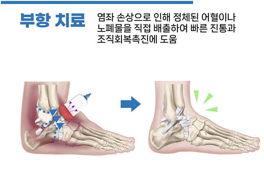 이수한의원 건강 칼럼 이미지