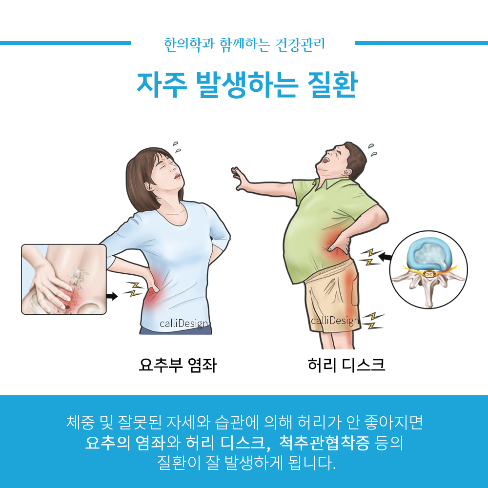 이수한의원 건강 칼럼 이미지