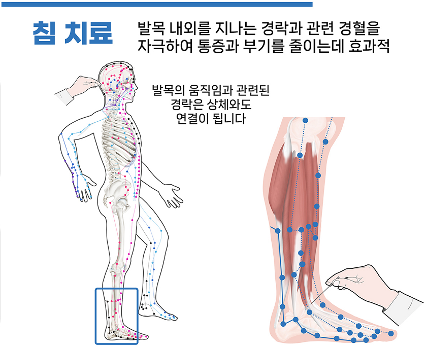 이수한의원 건강 칼럼 이미지