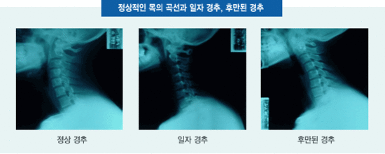 이수한의원 건강 칼럼 이미지