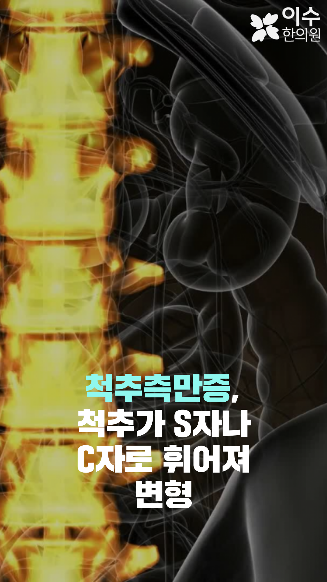 이수한의원 건강 칼럼 이미지