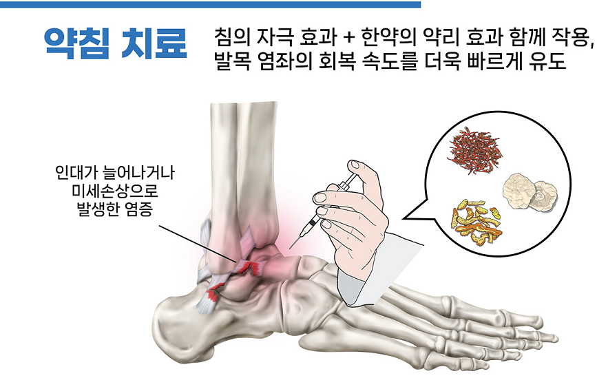 이수한의원 건강 칼럼 이미지