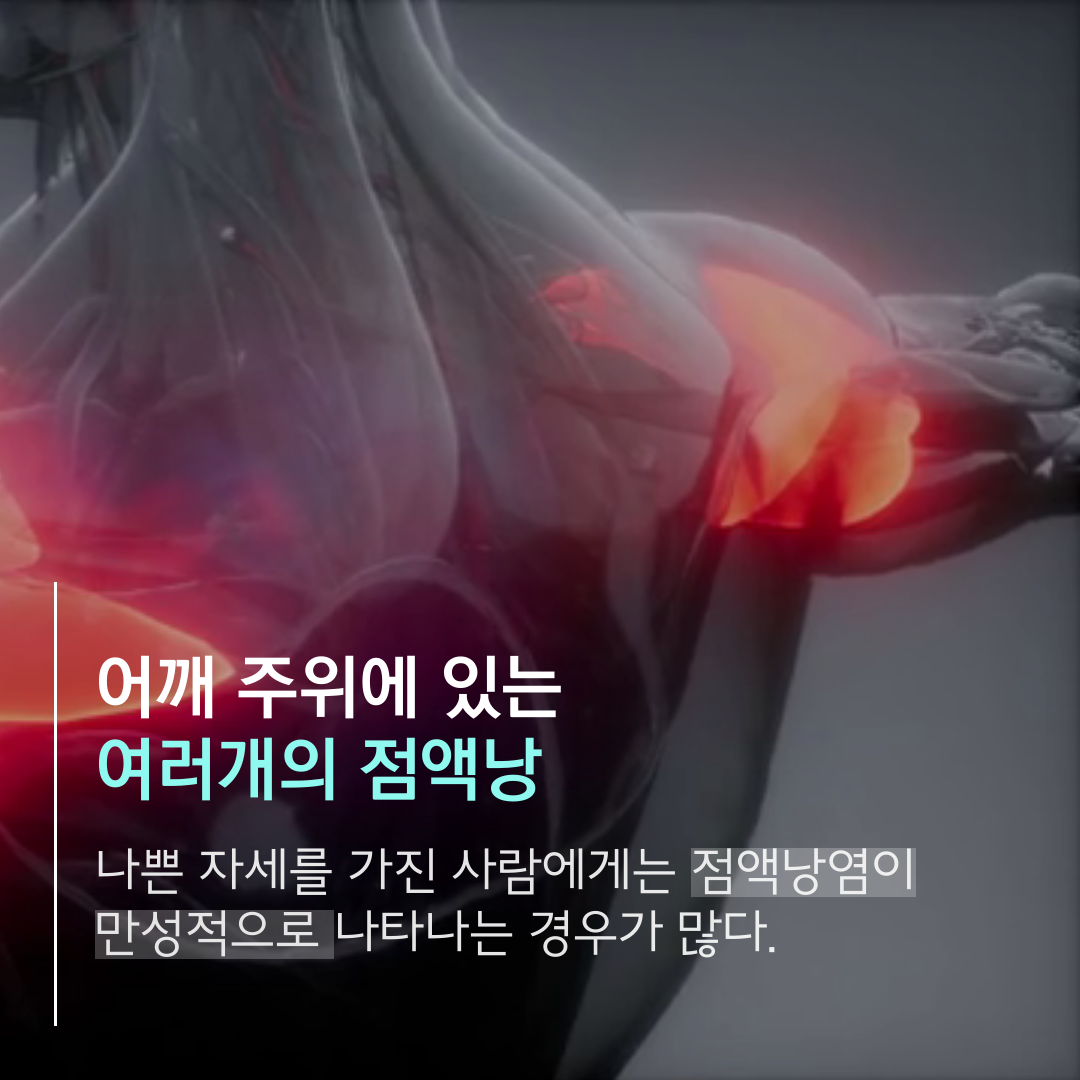 이수한의원 건강 칼럼 이미지