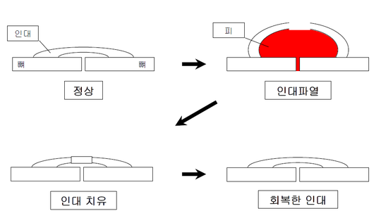 이수한의원 건강 칼럼 이미지