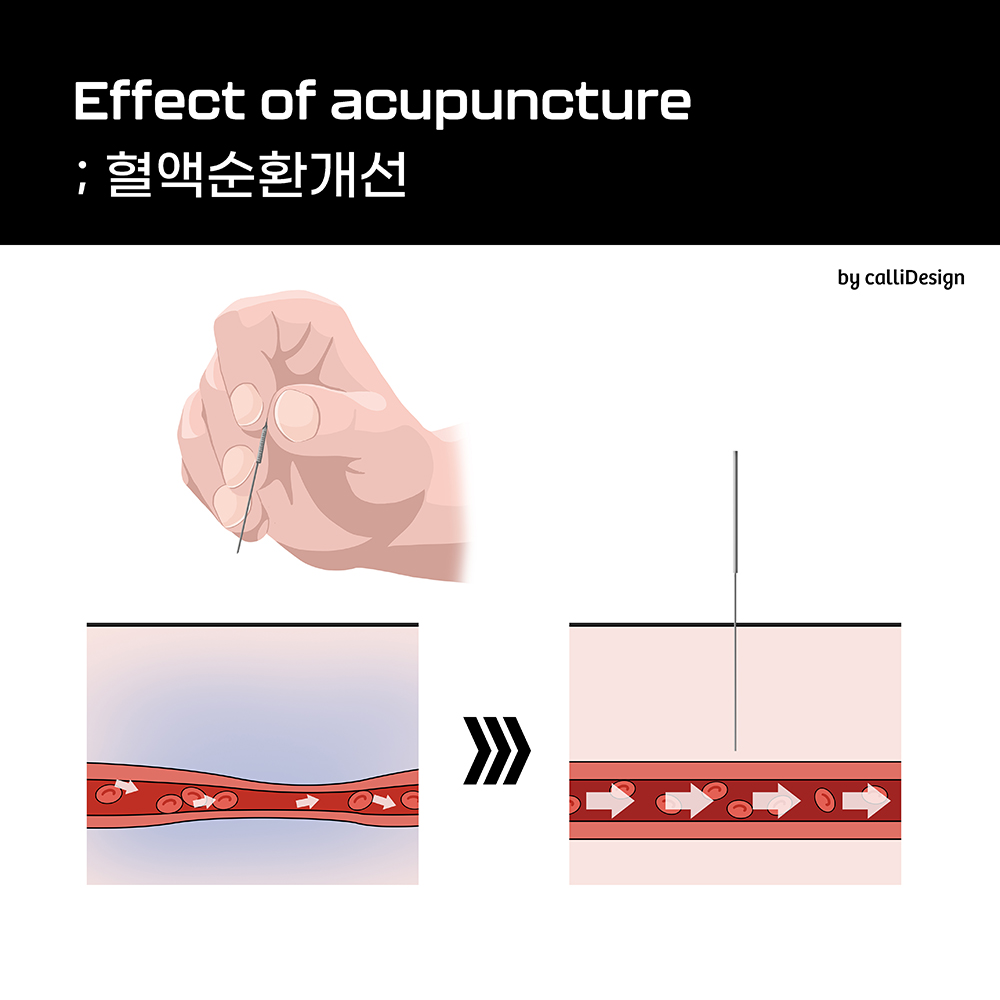 이수한의원 건강 칼럼 이미지