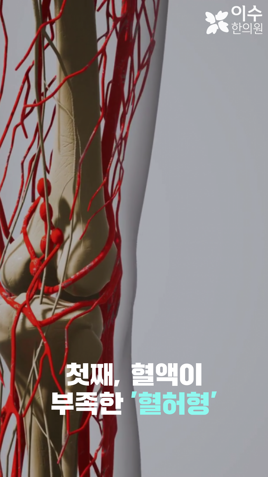 이수한의원 건강 칼럼 이미지