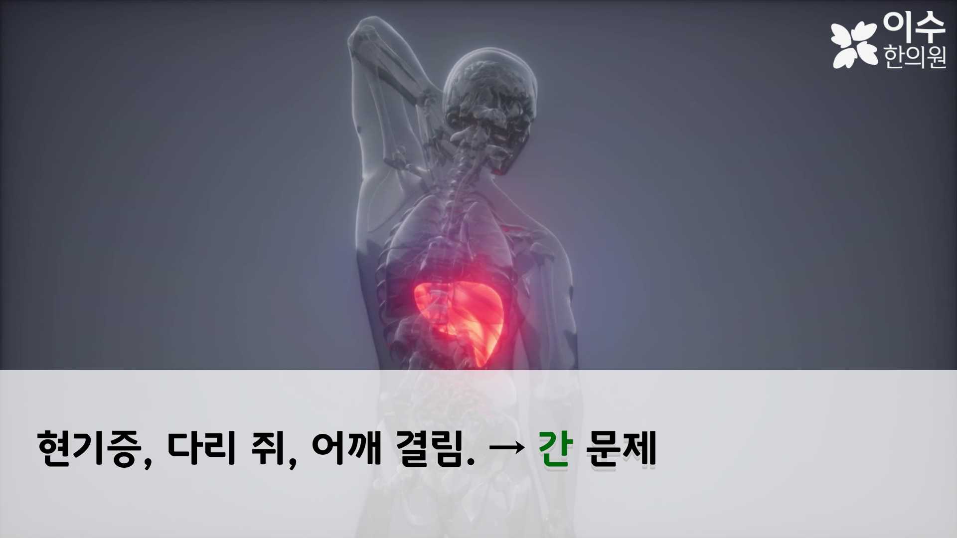 이수한의원 건강 칼럼 이미지