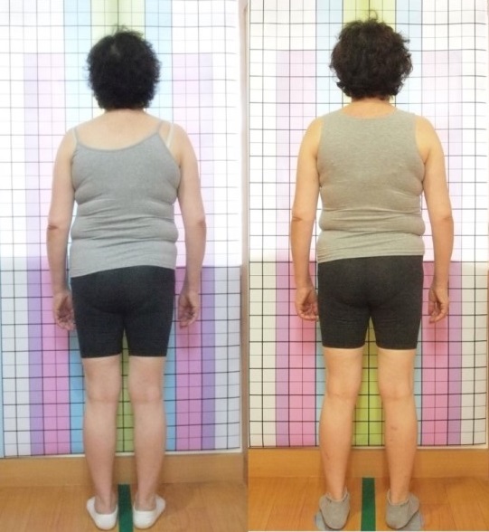 이수한의원 건강 칼럼 이미지