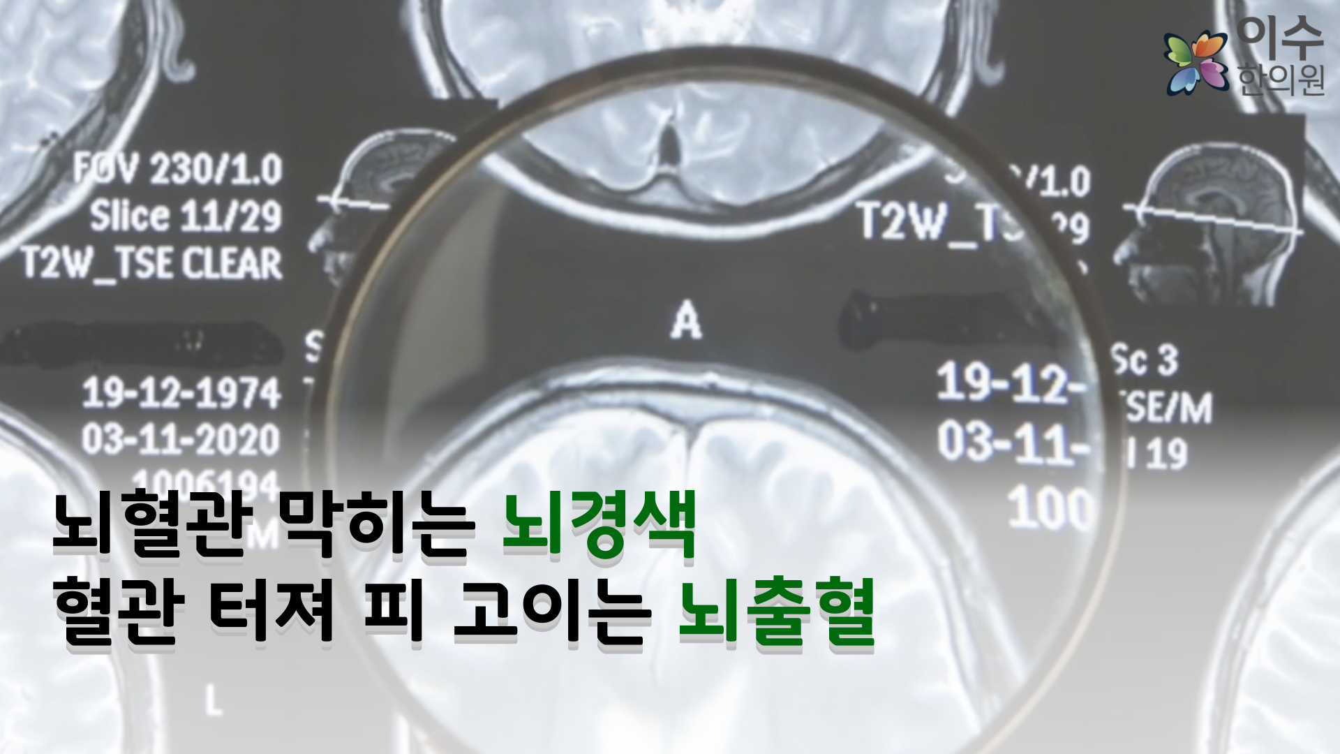 이수한의원 건강 칼럼 이미지