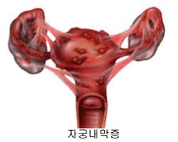 이수한의원 건강 칼럼 이미지