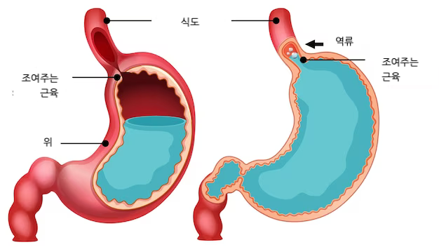 이수한의원 건강 칼럼 이미지