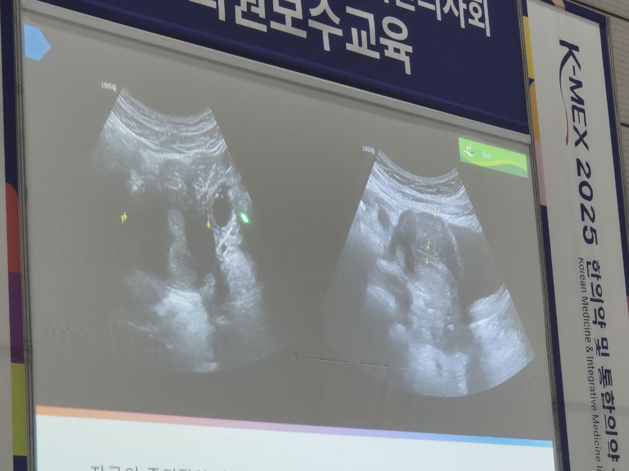 이수한의원 건강 칼럼 이미지