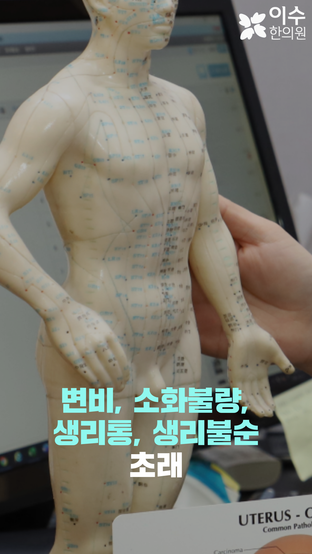 이수한의원 건강 칼럼 이미지