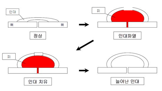 이수한의원 건강 칼럼 이미지