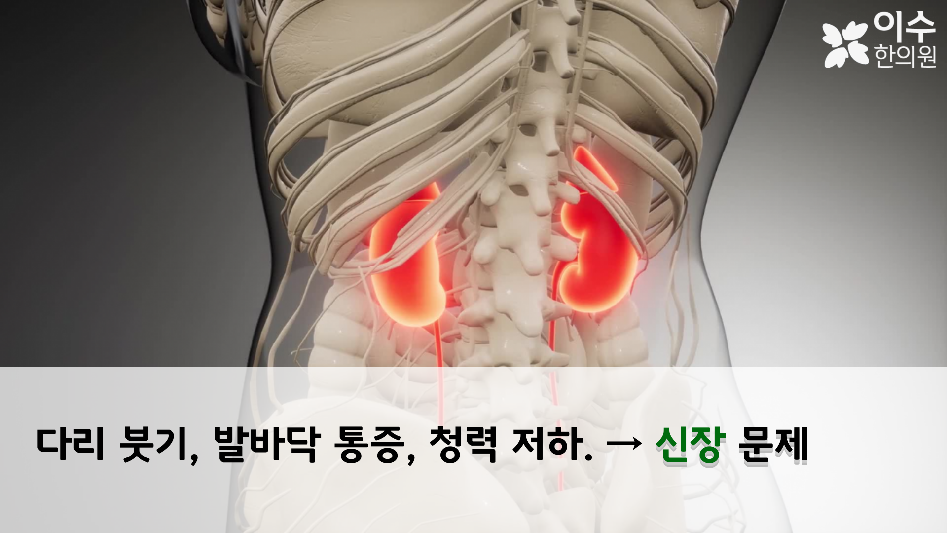 이수한의원 건강 칼럼 이미지