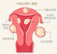 이수한의원 건강 칼럼 이미지