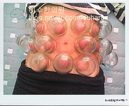 이수한의원 건강 칼럼 이미지