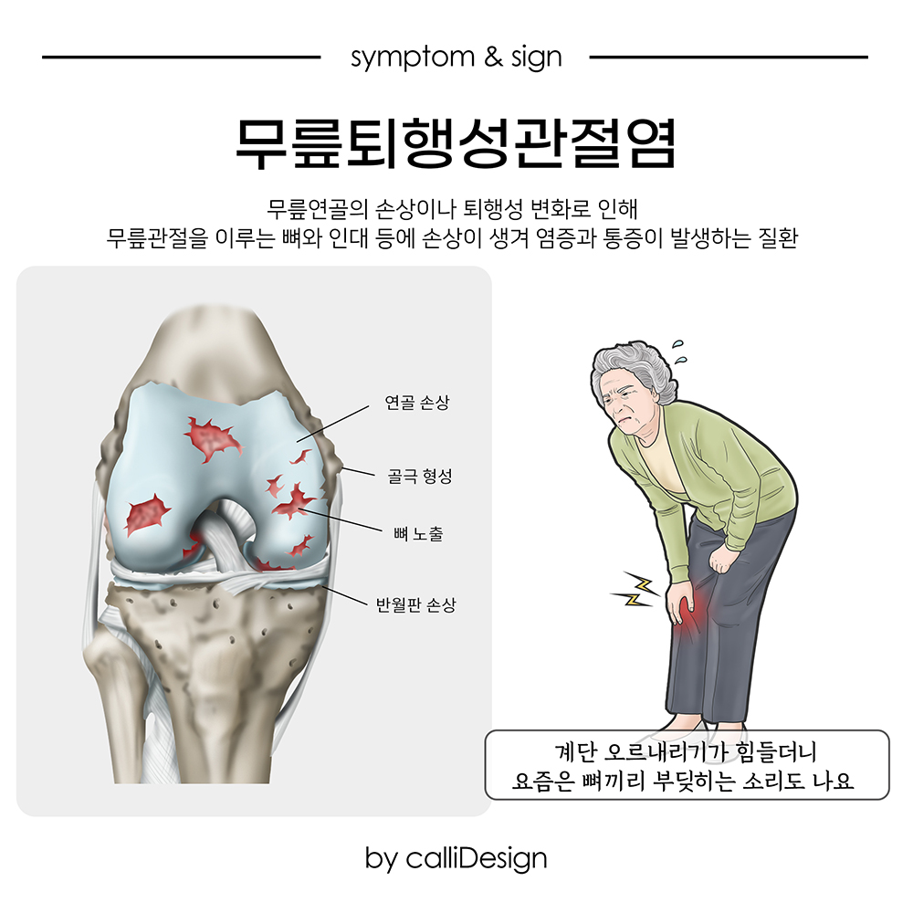 이수한의원 건강 칼럼 이미지