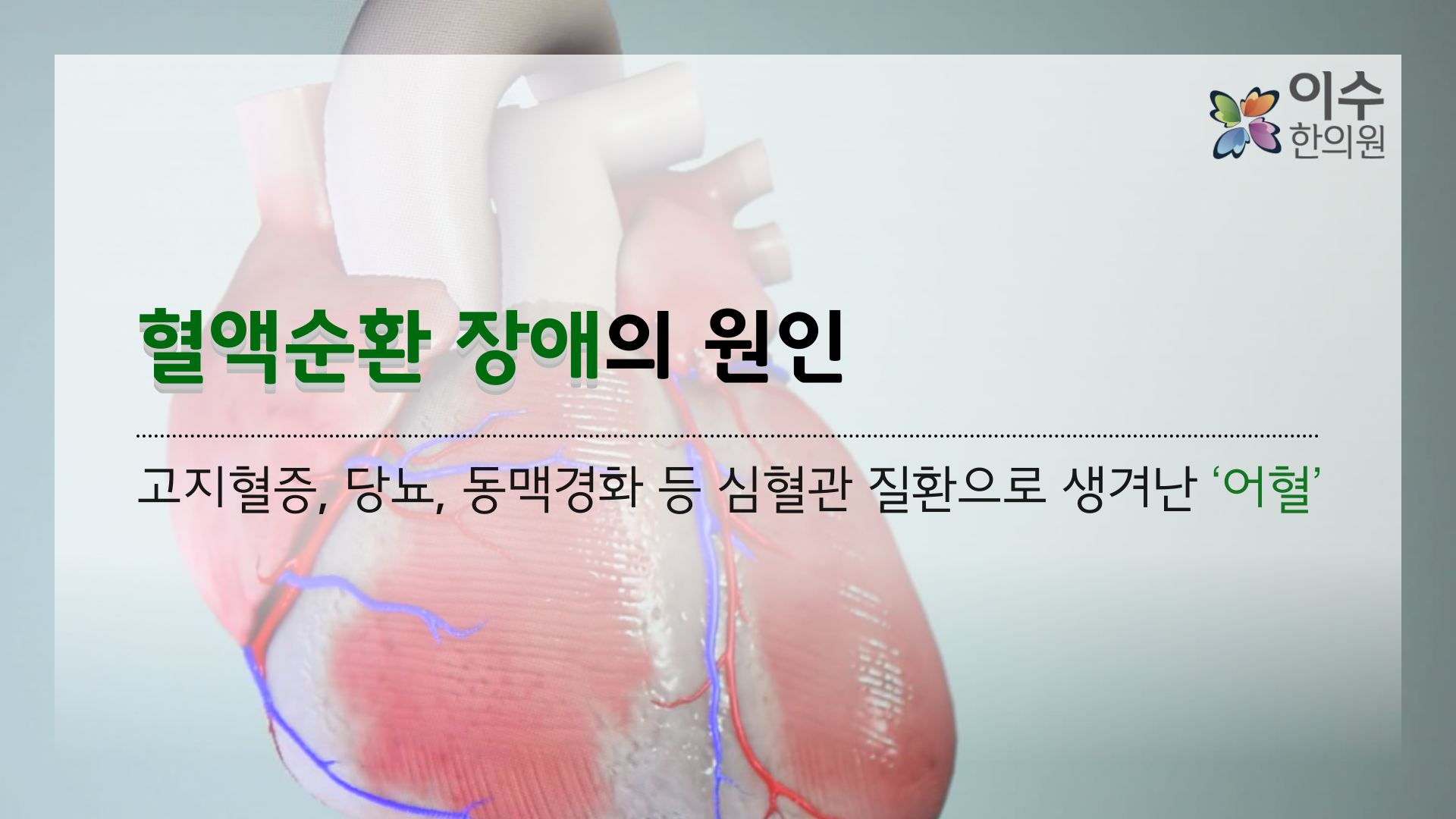 이수한의원 건강 칼럼 이미지