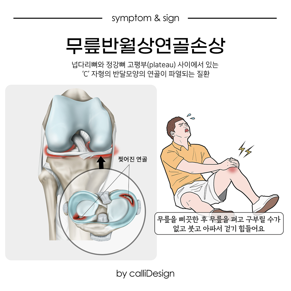 이수한의원 건강 칼럼 이미지