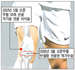 이수한의원 건강 칼럼 이미지