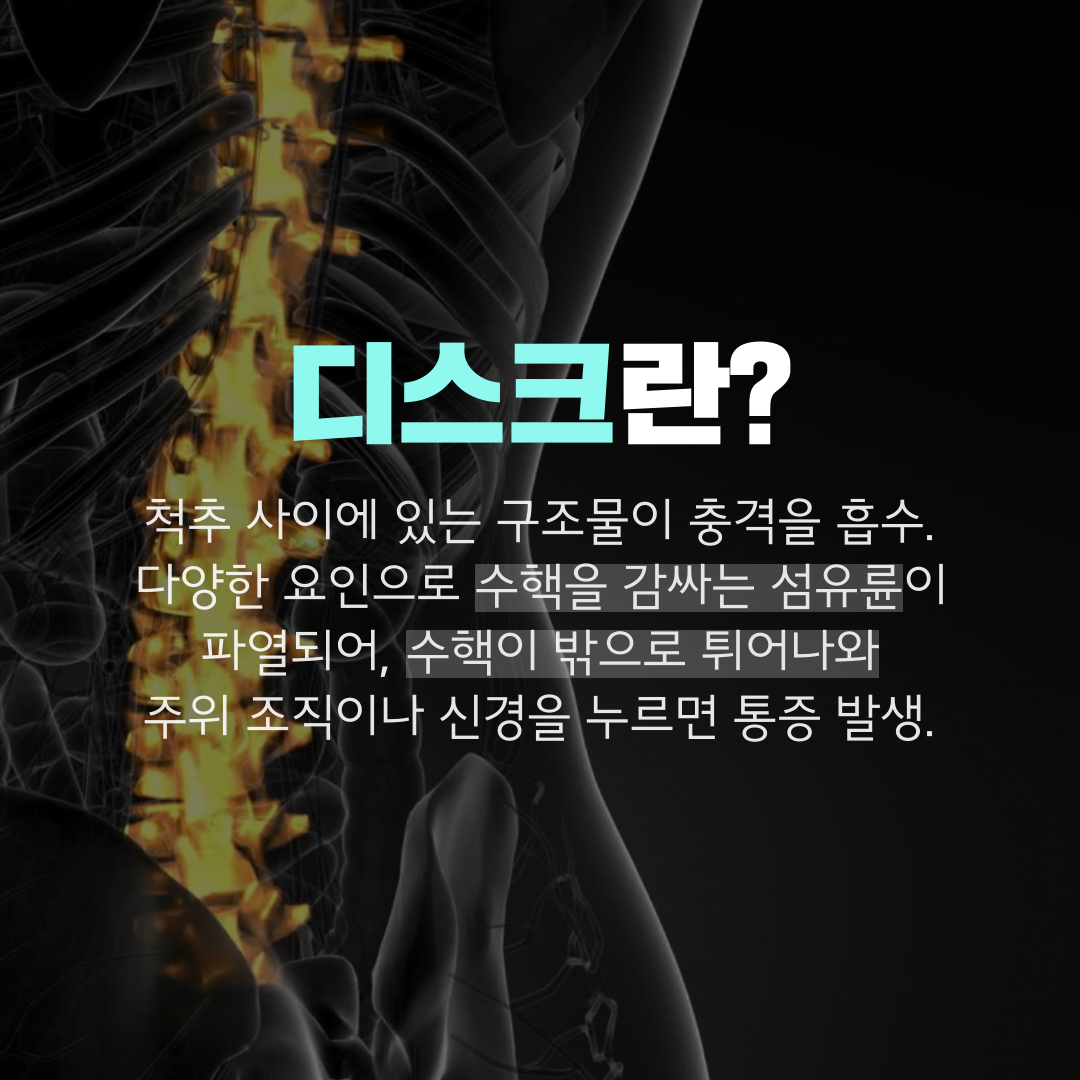 이수한의원 건강 칼럼 이미지