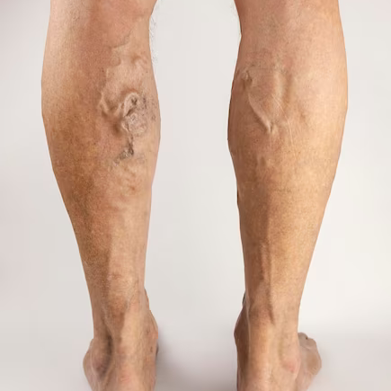 이수한의원 건강 칼럼 이미지