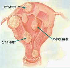 이수한의원 건강 칼럼 이미지