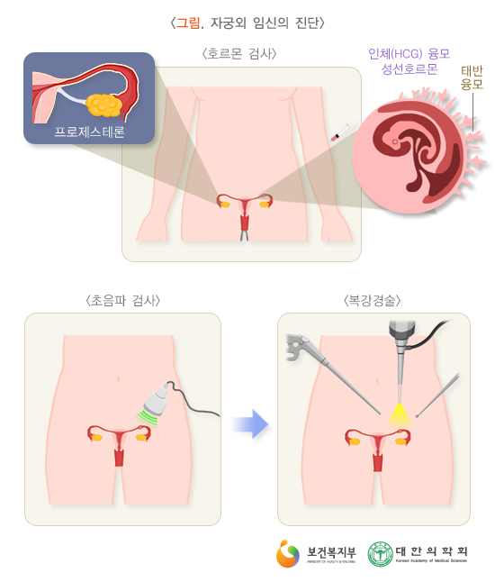 이수한의원 건강 칼럼 이미지