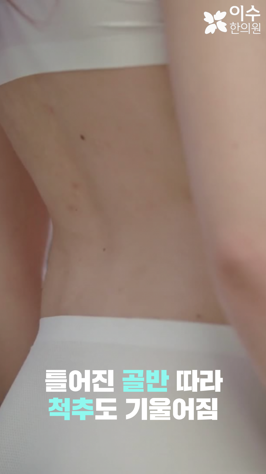 이수한의원 건강 칼럼 이미지