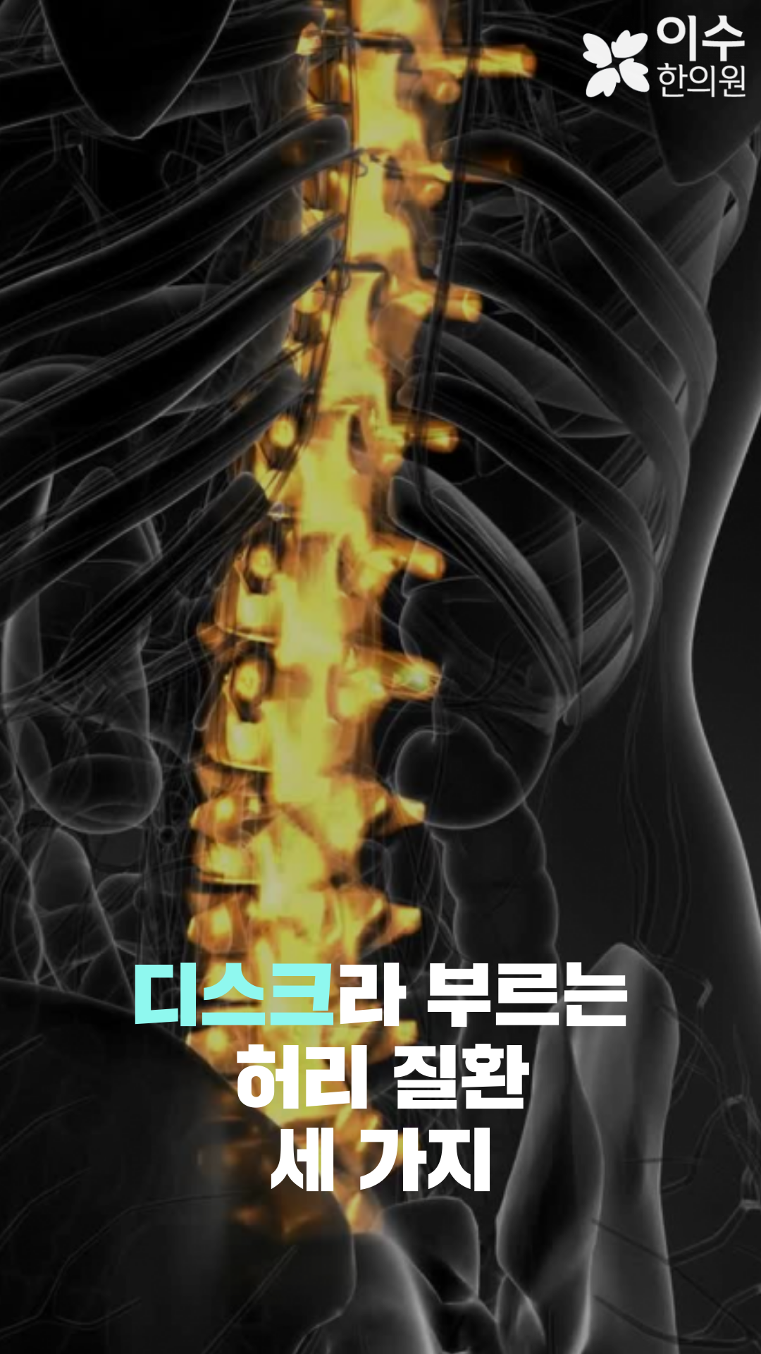 이수한의원 건강 칼럼 이미지