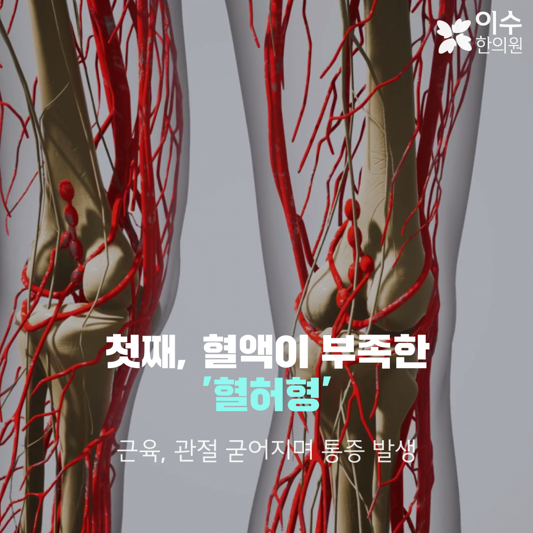이수한의원 건강 칼럼 이미지