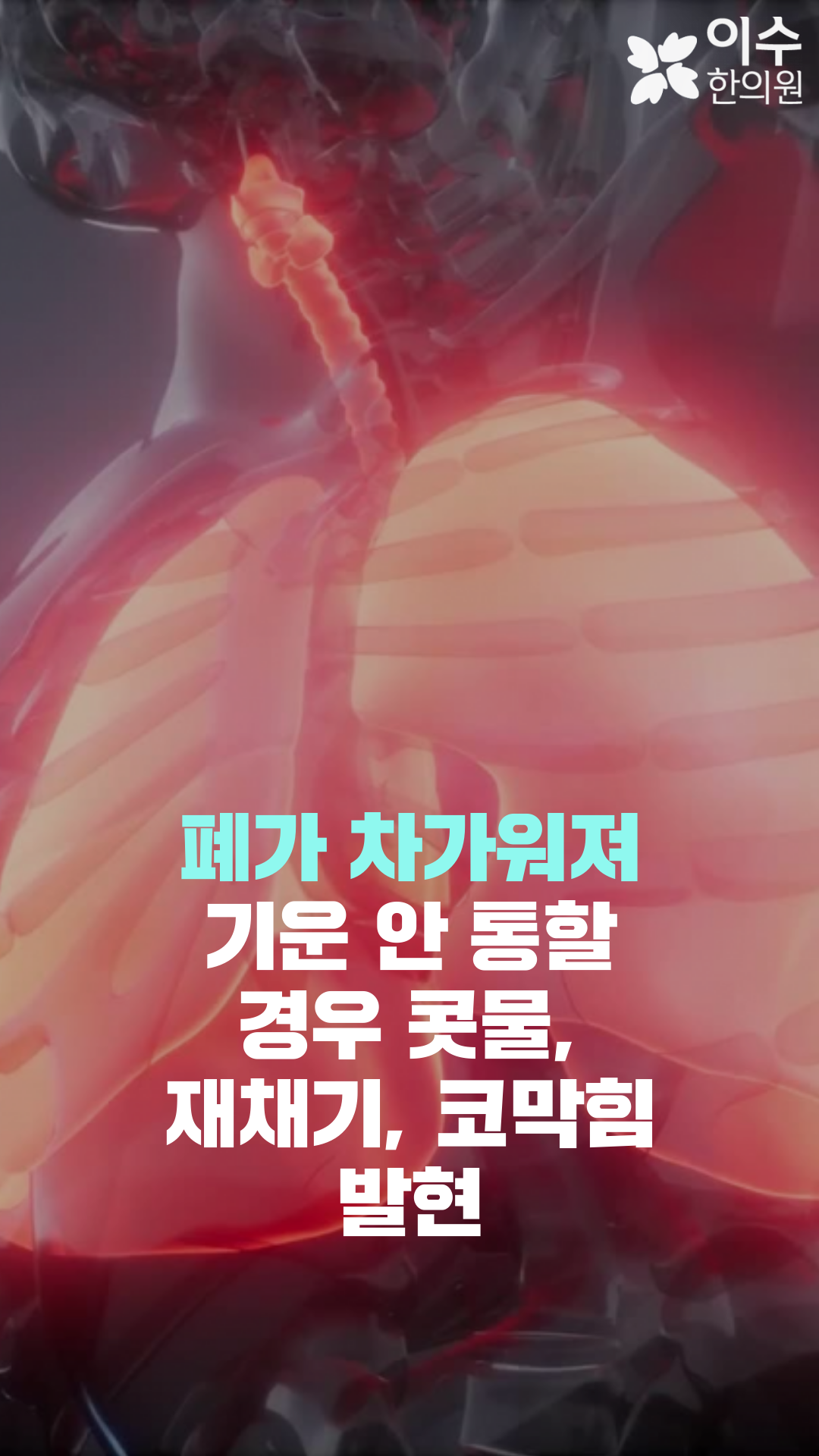 이수한의원 건강 칼럼 이미지