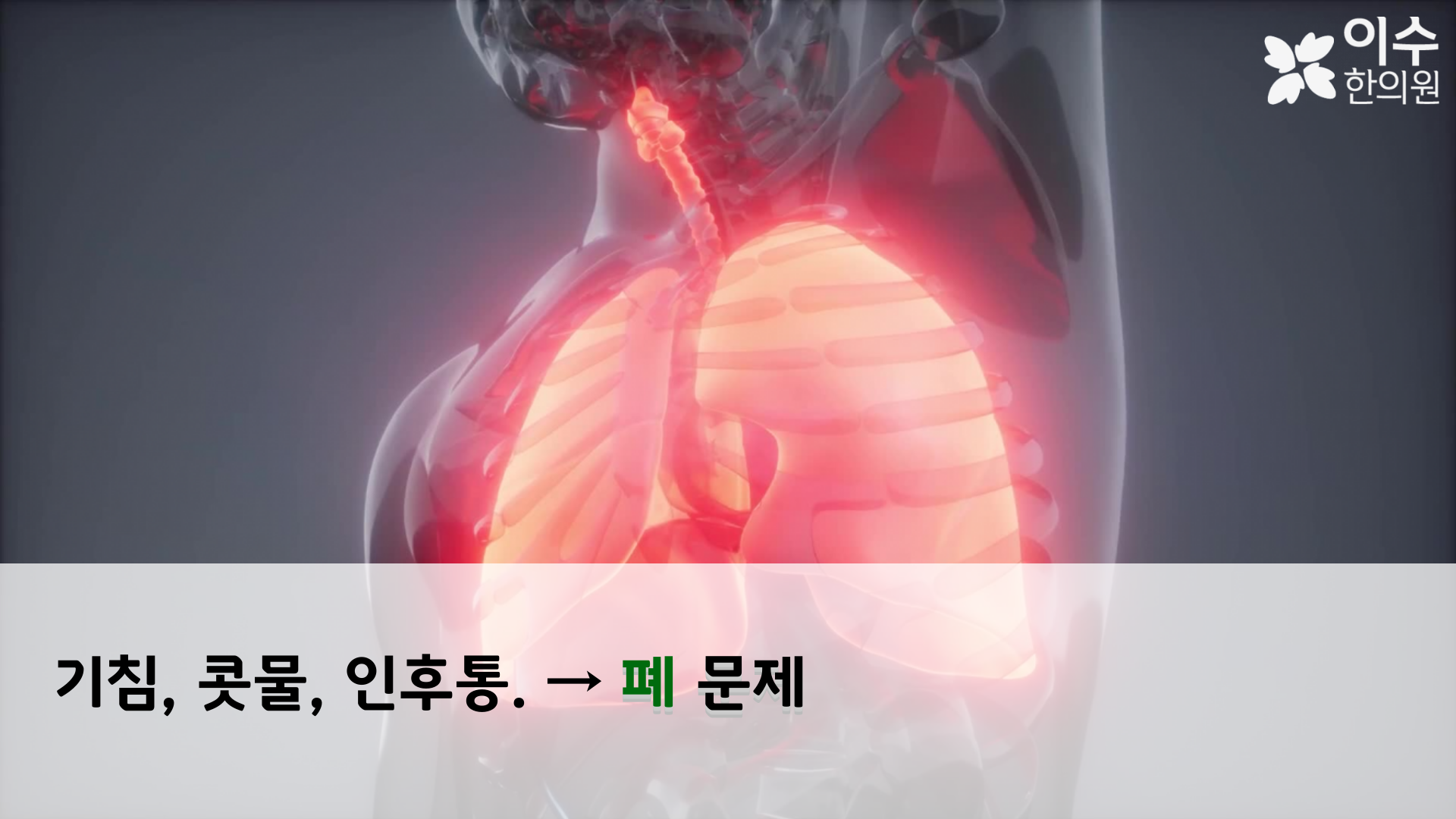 이수한의원 건강 칼럼 이미지