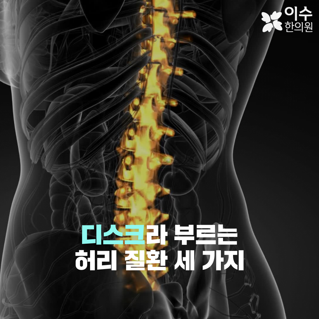 이수한의원 건강 칼럼 이미지