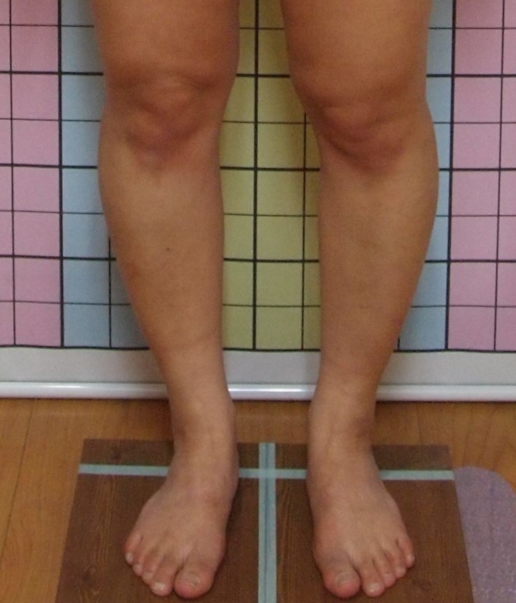 이수한의원 건강 칼럼 이미지
