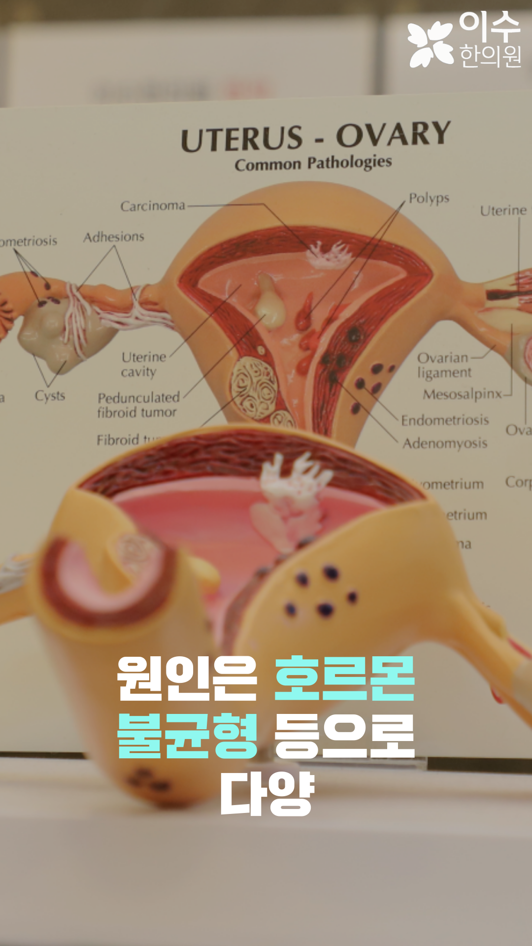 이수한의원 건강 칼럼 이미지