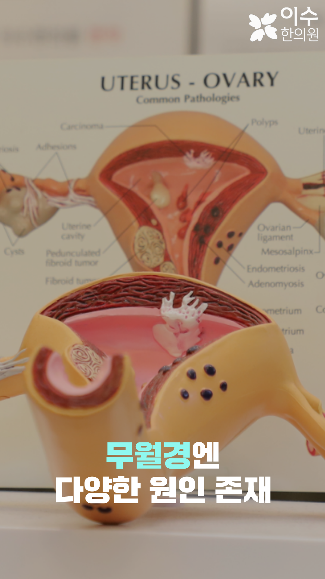 이수한의원 건강 칼럼 이미지