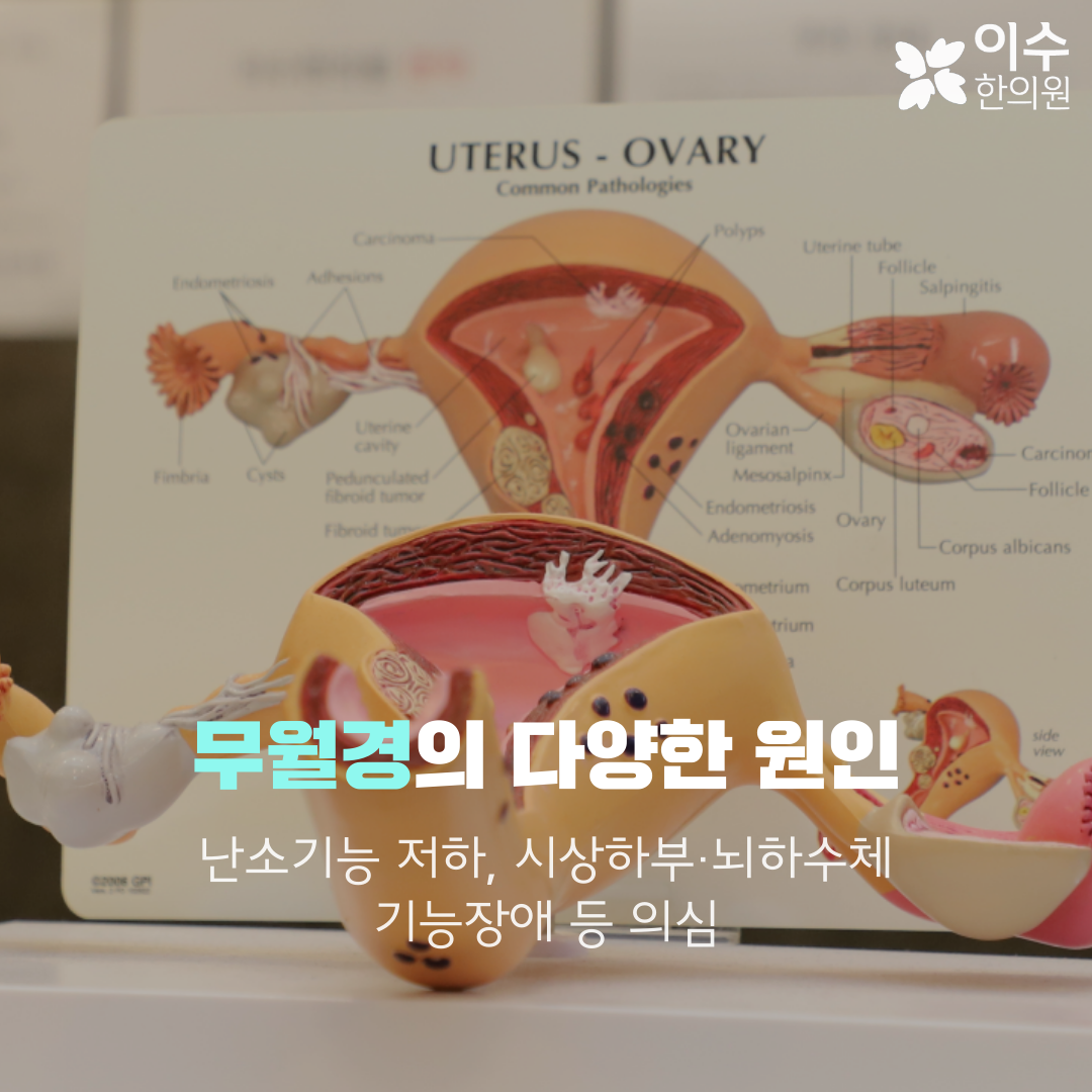 이수한의원 건강 칼럼 이미지