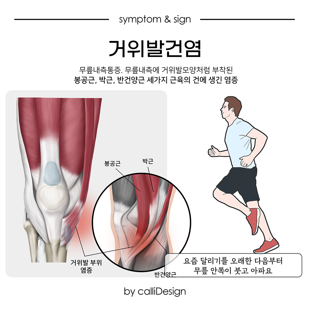 이수한의원 건강 칼럼 이미지
