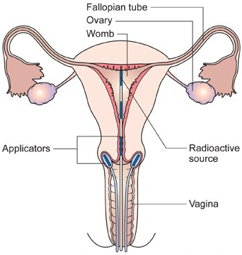 이수한의원 건강 칼럼 이미지
