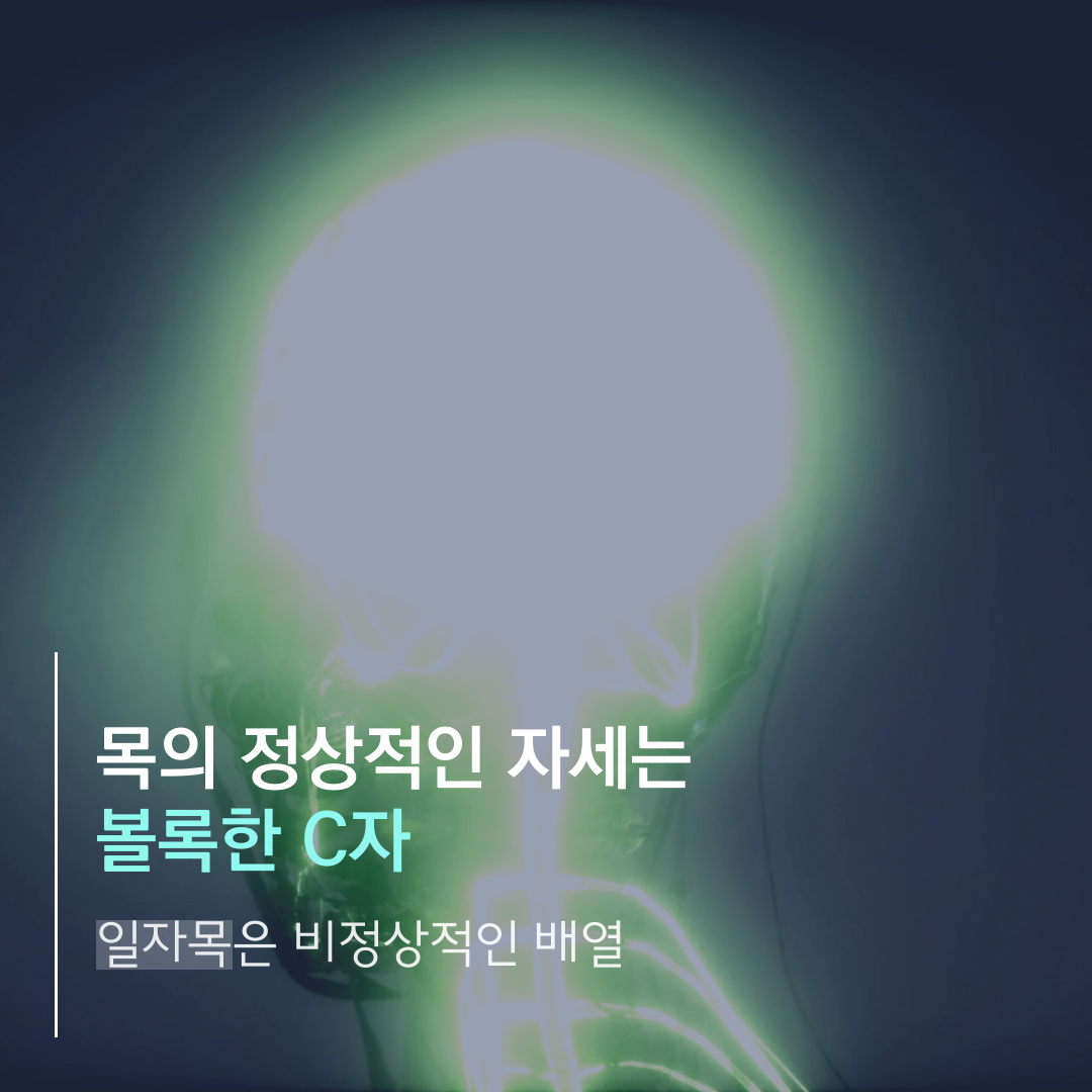 이수한의원 건강 칼럼 이미지