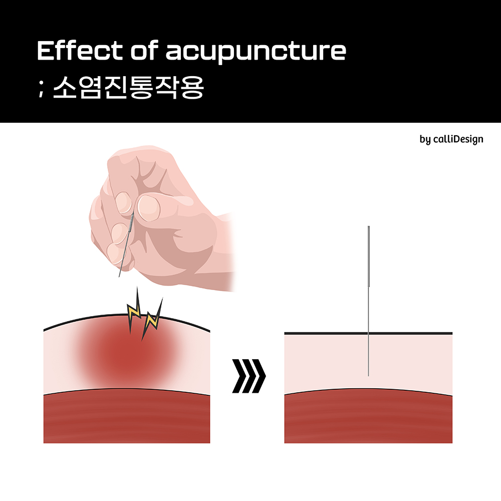 이수한의원 건강 칼럼 이미지