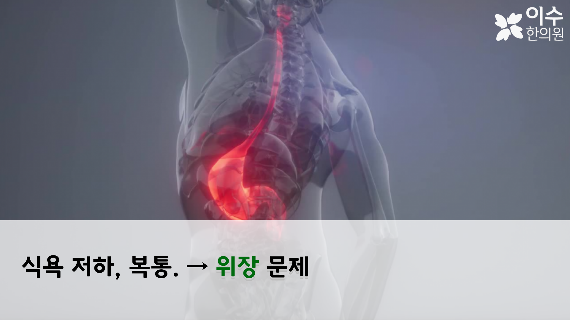 이수한의원 건강 칼럼 이미지