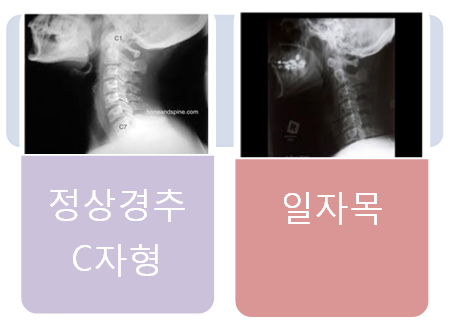 이수한의원 건강 칼럼 이미지