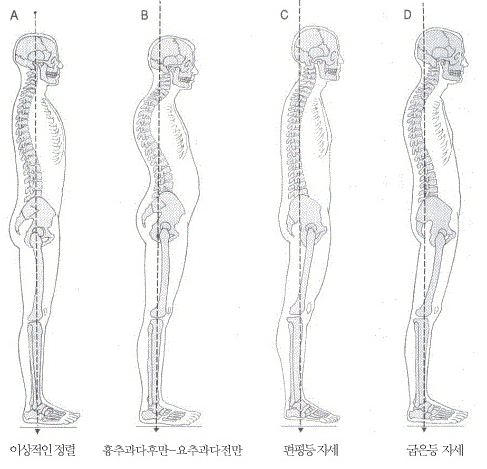 이수한의원 건강 칼럼 이미지