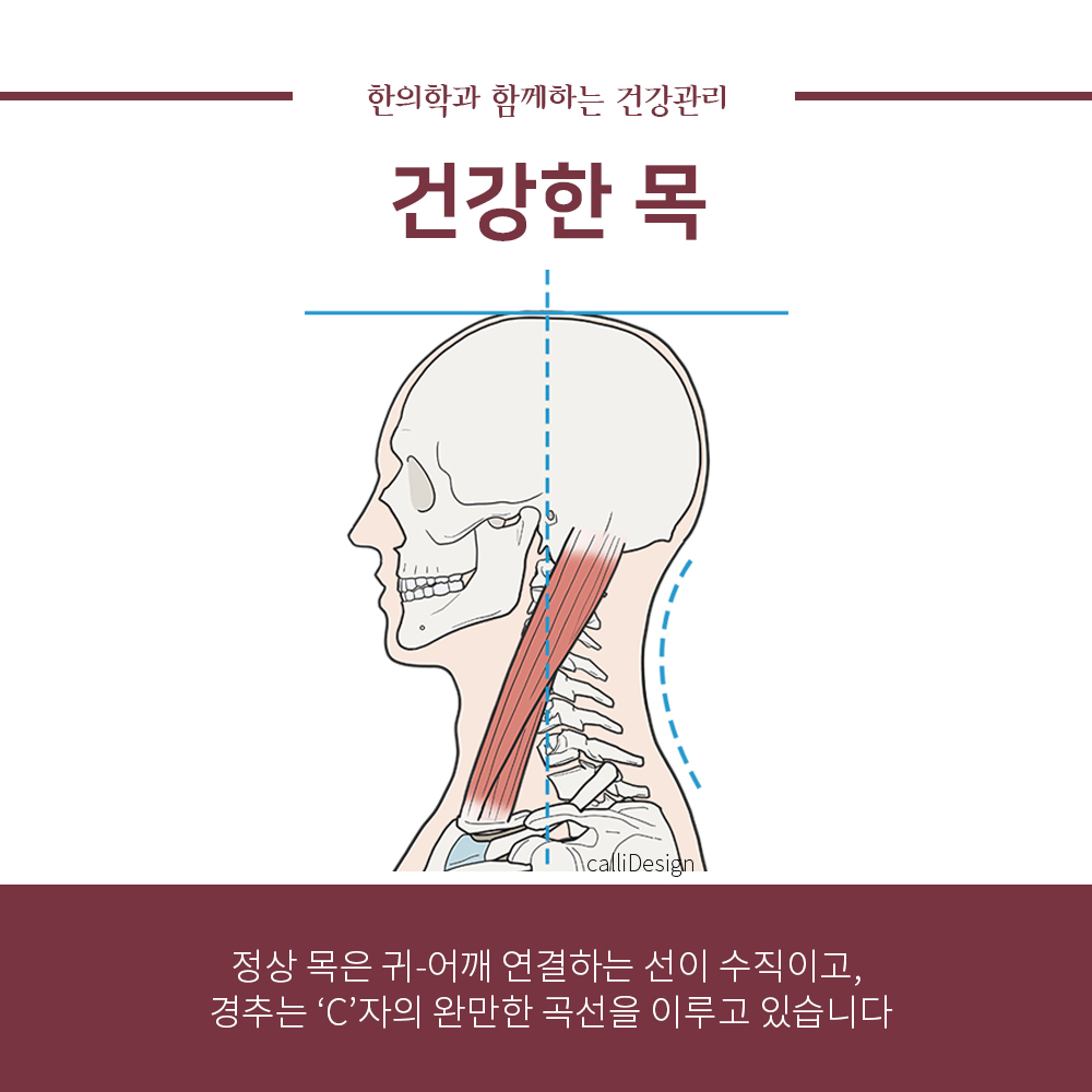 이수한의원 건강 칼럼 이미지