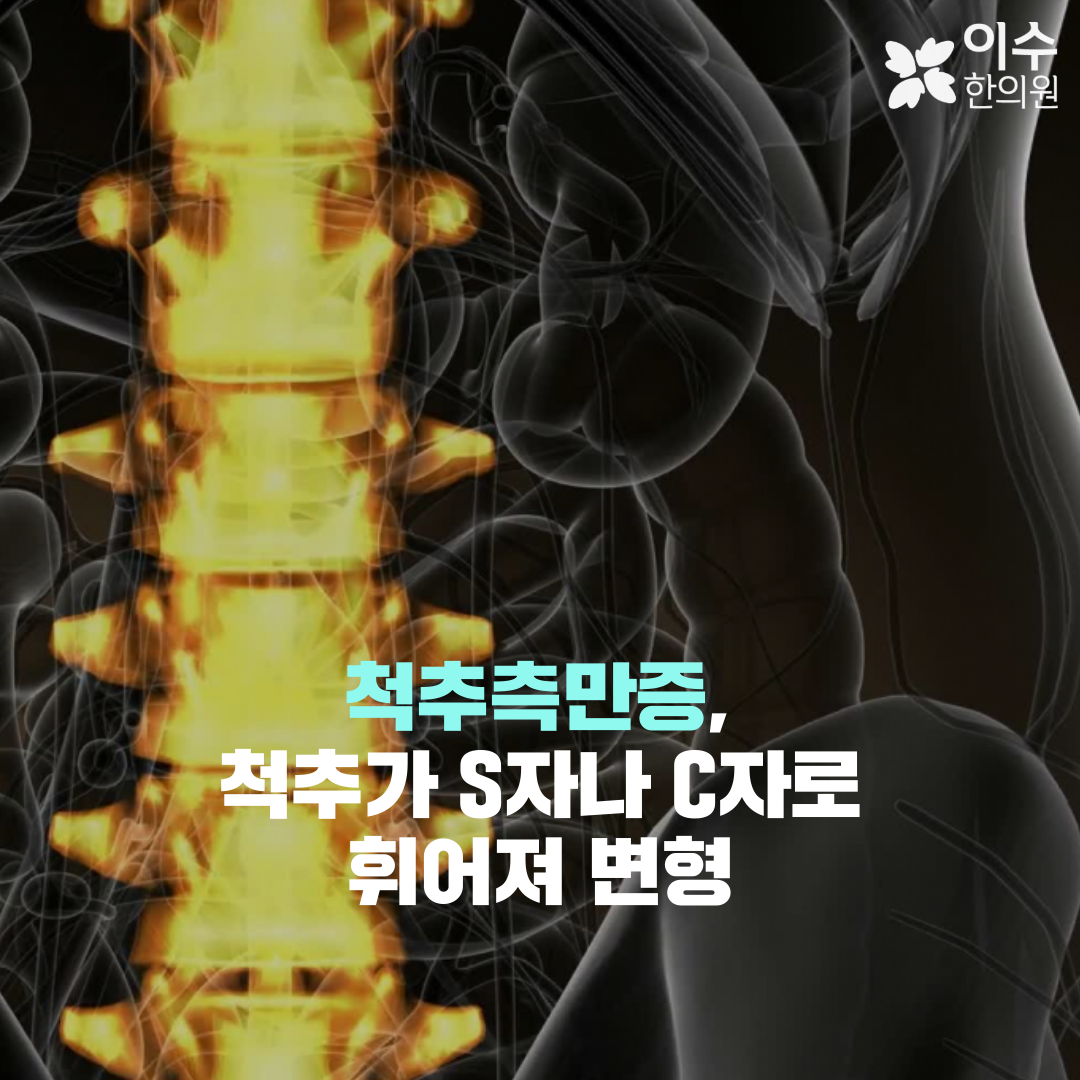이수한의원 건강 칼럼 이미지
