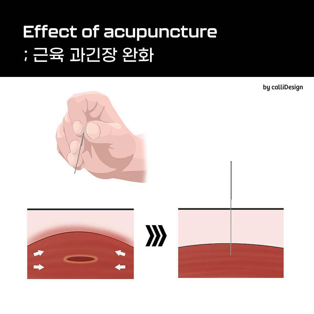 이수한의원 건강 칼럼 이미지