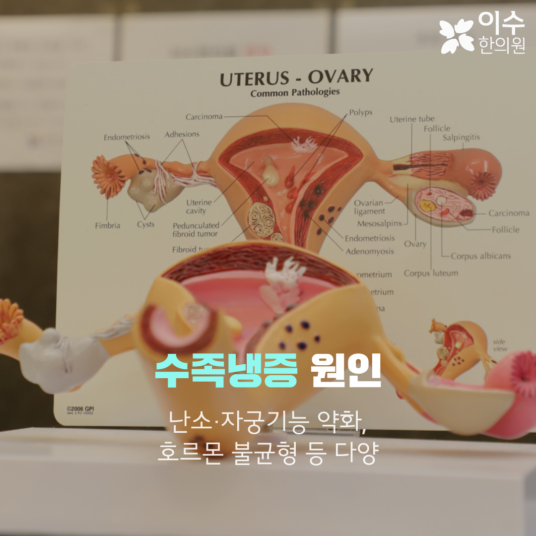 이수한의원 건강 칼럼 이미지